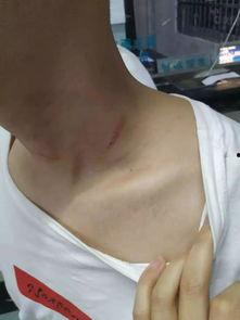 温州网友打架爆料事件视频,网络暴力引发现实冲突  第1张